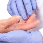 آرتریت روماتوئید (RA)