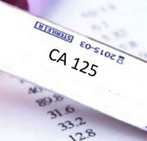 آزمایش ca 125