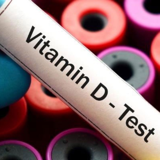 آزمایش ویتامین دی | Vitamin D Test
