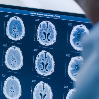 سی تی اسکن | CT Scan