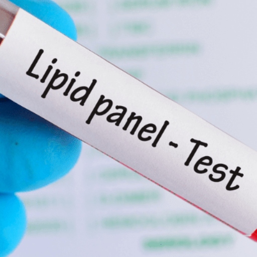 آزمایش های چربی خون | Lipid Panel