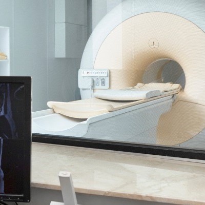 ام آر آی | MRI