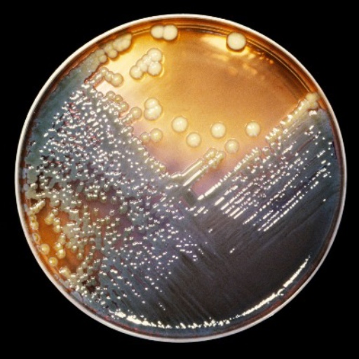 آزمایش های کشت باکتریایی | Bacterial Culture Tests