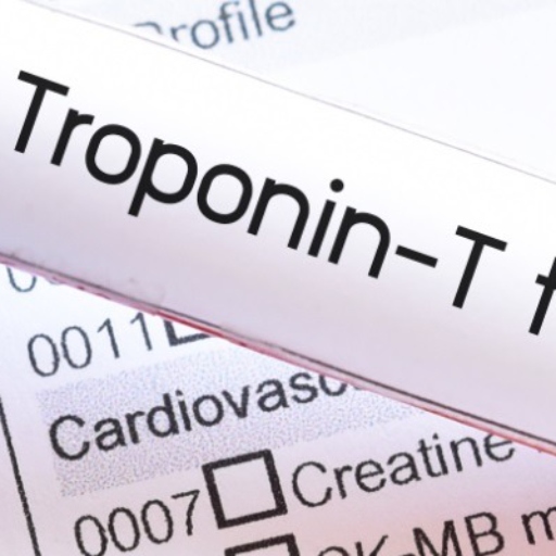 آزمایش تروپونین | Troponin Test