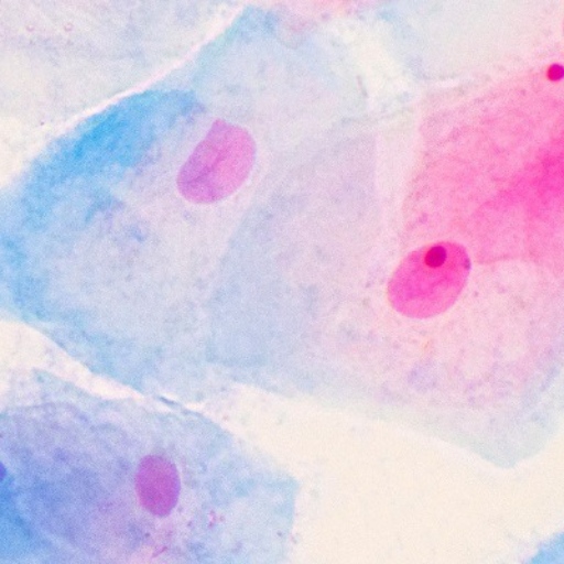 پاپ اسمیر | Pap Smear