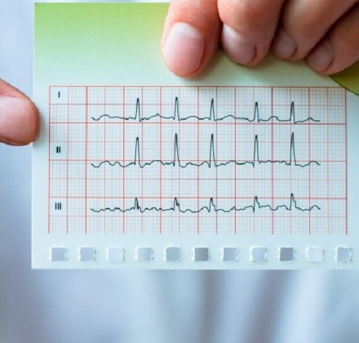 نوار قلب | Electrocardiogram