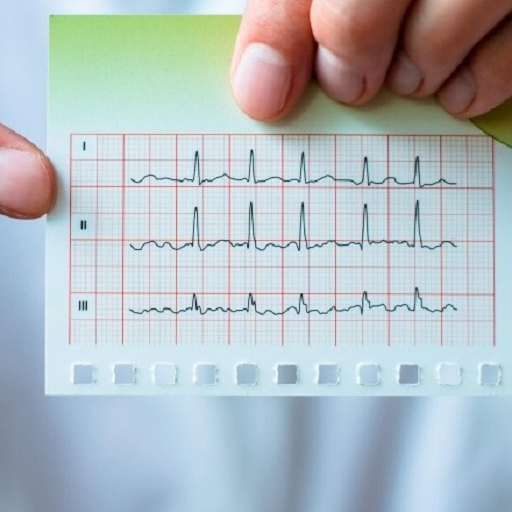 نوار قلب | Electrocardiogram