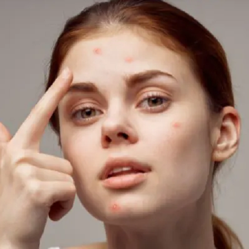 نبرد علیه جوش صورت؛ راهنمایی برای رسیدن به پوستی شفاف