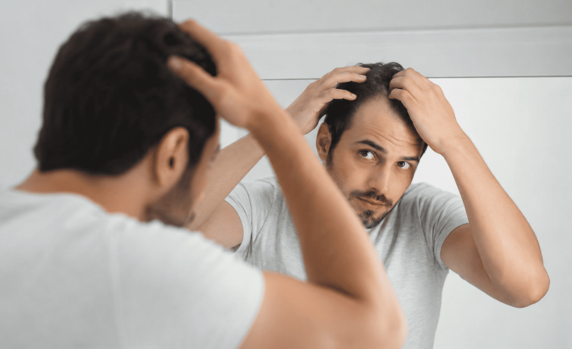 فیناستراید برای درمان ریزش موی ارثی در مردان