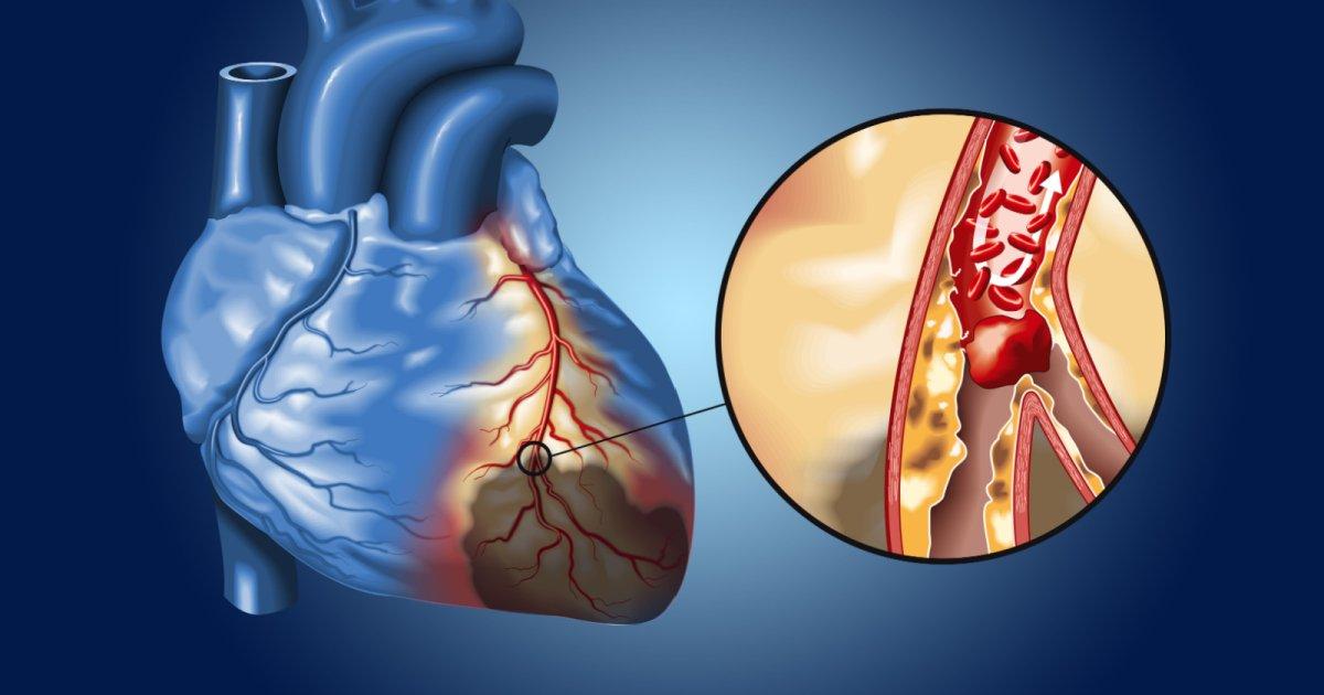 بیماری‌های قلبی چگونه ایجاد می‌شوند؟