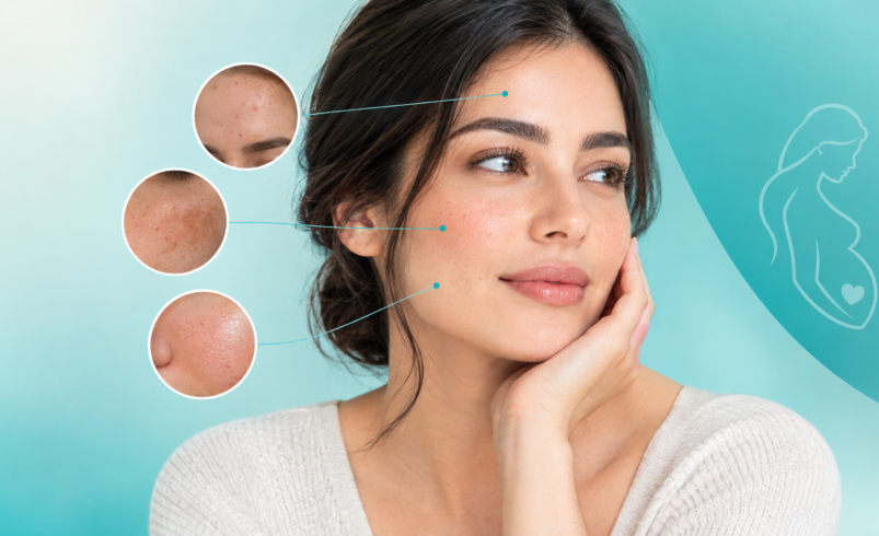علائم بارداری از روی چهره